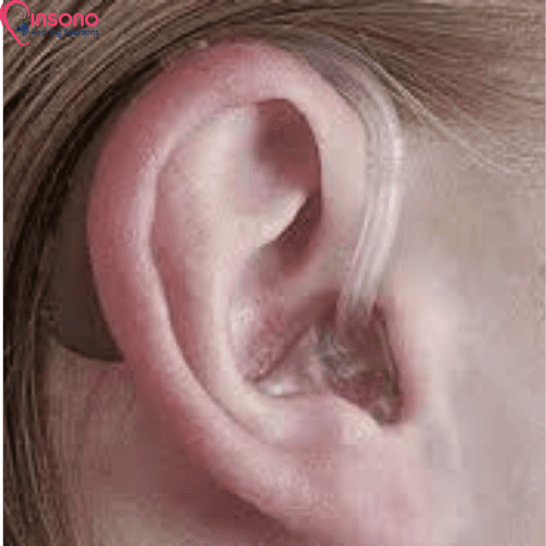 Signia Intuis 4.7 (SP/P/M) view 5