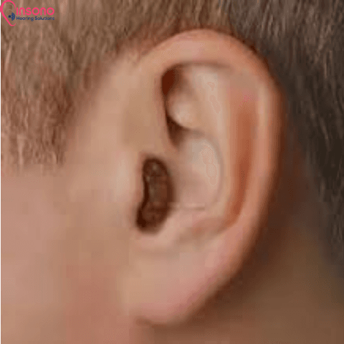 OTICON HIT CIC view 2