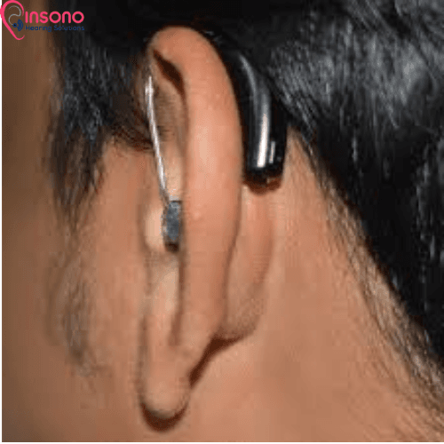 OTICON NERA POWER BTE (WL) view 4