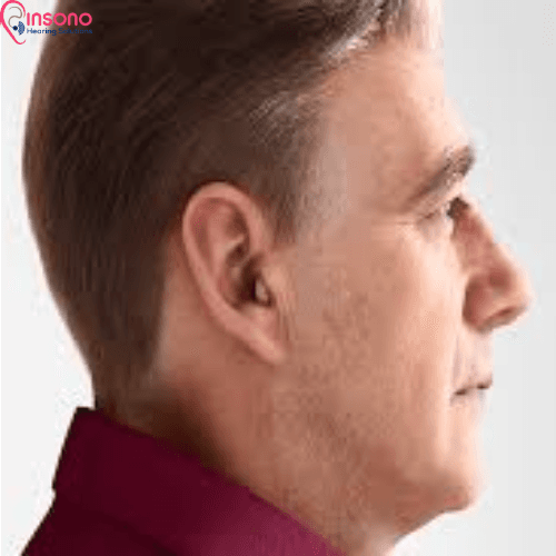 ReSound Nexia 7 CIC view 3