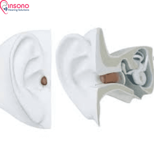 ReSound Nexia 5 CIC view 4