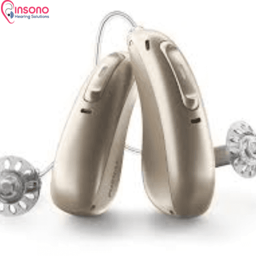 Phonak Terra+ RIC 312 view 5