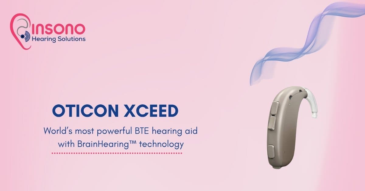 Oticon Xceed: The Most Effective Hearing Aid in the World for Severe to Severe Hearing Loss (2025 Guide)
